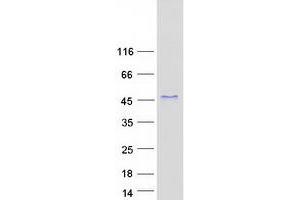 Western Blotting (WB) image for Cysteine-Rich with EGF-Like Domains 2 (CRELD2) (Transcript Variant 2) protein (Myc-DYKDDDDK Tag) (ABIN2712555)
