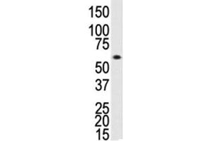 Western blot analysis of ALK3 antibody and human Saos-2 cell lysate. (BMPR1A 抗体  (AA 30-60))