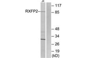 Western blot analysis of extracts from Jurkat cells, using RXFP2 Antibody. (RXFP2 抗体  (AA 113-162))