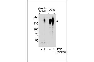 Western blot analysis of extracts from A431 cells, untreated or treated with EGF, using phospho-ERBB2- (left) or ErBB2 Antibody (right). (ErbB2/Her2 抗体  (pSer1107))