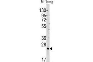 Western Blotting (WB) image for anti-BH3 Interacting Domain Death Agonist (BID) (BH3 Domain) antibody (ABIN2997129) (BID 抗体  (BH3 Domain))