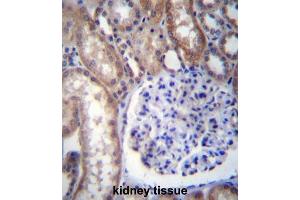 Immunohistochemistry (IHC) image for anti-Guanine Nucleotide Binding Protein (G Protein), alpha 14 (GNa14) antibody (ABIN2996930) (GNa14 抗体)