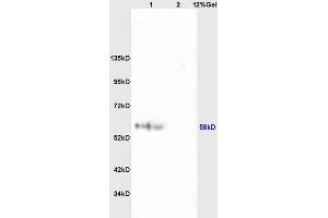 Lane 1: mouse brain lysates Lane 2: mouse heart lysates probed with Anti phospho-RPS6KB1(Ser427) Polyclonal Antibody, Unconjugated (ABIN713006) at 1:200 in 4 °C. (RPS6KB1 抗体  (pSer427))