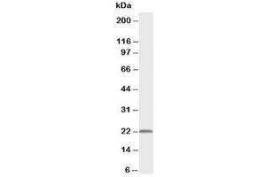 Western blot testing of PMVK antibody and rat heart tissue lysate (PMVK 抗体  (Middle Region))