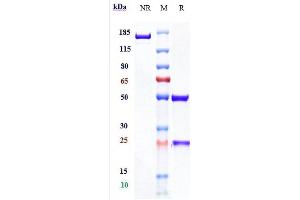 Anti-PDCD1 / PD-1 / CD279 Reference Antibody (spartalizumab) on SDS-PAGE under reducing (R) condition. (Recombinant PDCD1 (Spartalizumab Biosimilar) 抗体)