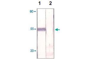 The HeLa cell lysate was immuno-blotted by FOXP1 polyclonal antibody  at 1 : 500 (Lane 1). (FOXP1 抗体  (C-Term))