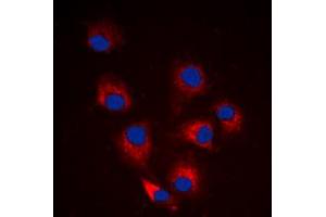 Immunofluorescent analysis of BIM (pS69) staining in HeLa cells. (BIM 抗体  (pSer69))