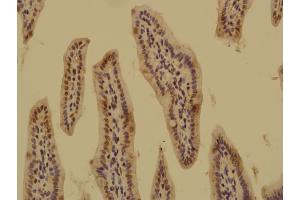 Immunohistochemistry (Paraffin-embedded Sections) (IHC (p)) image for anti-ArfGAP with SH3 Domain, Ankyrin Repeat and PH Domain 1 (ASAP1) (AA 154-190) antibody (ABIN753703)
