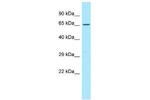 WB Suggested Anti-CD96 Antibody Titration: 1. (CD96 抗体  (C-Term))
