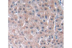 IHC-P analysis of liver tissue, with DAB staining. (PLA2G3 抗体  (AA 20-268))