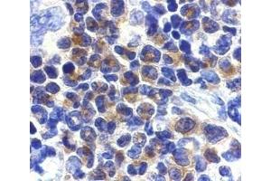 Immunohistochemical staining of DAPK2 in mouse spleen cells with DAPK2 antibody at 2μg/ml. (DAPK2 抗体  (AA 356-370))
