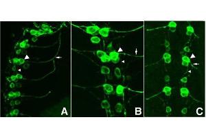 Immunofluorescence Microscopy of GFP-GOAT-Antibody.