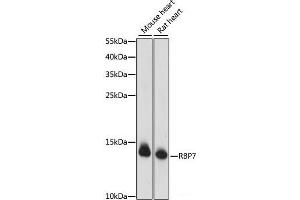 Western blot analysis of extracts of various cell lines using RBP7 Polyclonal Antibody at dilution of 1:1000. (RBP7 抗体)