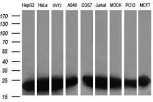 Image no. 6 for anti-Prefoldin Subunit 3 (PFDN3) antibody (ABIN1501701) (VBP1 抗体)