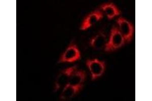 Immunofluorescent analysis of ADH5 staining in HepG2 cells. (ADH5 抗体)