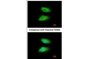 ICC/IF Image Immunofluorescence analysis of methanol-fixed HeLa, using IRAK2, antibody at 1:200 dilution. (IRAK2 抗体)