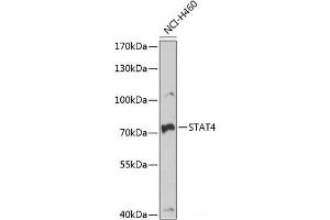 Western blot analysis of extracts of NCI-H460 cells using STAT4 Polyclonal Antibody at dilution of 1:1000. (STAT4 抗体)