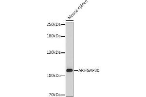 Western blot analysis of extracts of Mouse spleen, using  Rabbit pAb (ABIN7269965) at 1:1000 dilution. (ARHGAP30 抗体  (AA 485-585))
