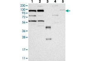 Western blot analysis of Lane 1: RT-4, Lane 2: U-251 MG, Lane 3: Human Plasma, Lane 4: Liver, Lane 5: Tonsil with KIF5C polyclonal antibody  at 1:250-1:500 dilution. (KIF5C 抗体)