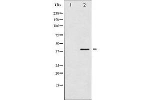 Western blot analysis of hnRNP C1/2 phosphorylation expression in H2O2 treated 293 whole cell lysates,The lane on the left is treated with the antigen-specific peptide. (HNRNPC 抗体  (pSer260))