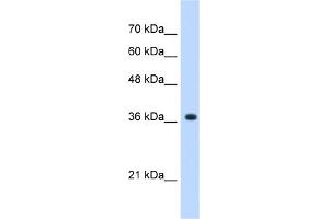 WB Suggested Anti-A4GNT Antibody Titration:  0. (A4GNT 抗体  (C-Term))