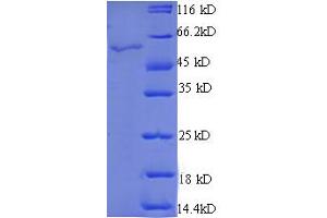 SDS-PAGE (SDS) image for StAR-Related Lipid Transfer (START) Domain Containing 7 (STARD7) (AA 61-307), (partial) protein (GST tag) (ABIN4974770) (STARD7 Protein (AA 61-307, partial) (GST tag))