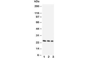 Western blot testing of HOXA6 antibody and Lane 1.