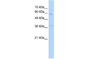ITGBL1 antibody used at 5 ug/ml to detect target protein. (ITGBL1 抗体)