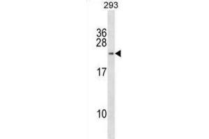 Western Blotting (WB) image for anti-H2B Histone Family, Member W, Testis-Specific (H2BFWT) antibody (ABIN2998902) (H2BFWT 抗体)