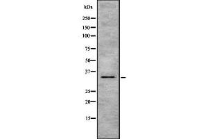 Western blot analysis of HSD17B1 using MCF7 whole  lysates. (HSD17B1 抗体  (C-Term))