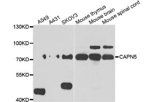 Western blot analysis of extracts of various cell lines, using CAPN5 antibody (ABIN5975527) at 1/1000 dilution. (Calpain 5 抗体)