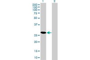 Western Blotting (WB) image for anti-Cyclin-Dependent Kinase 4 (CDK4) (AA 211-303) antibody (ABIN560292)