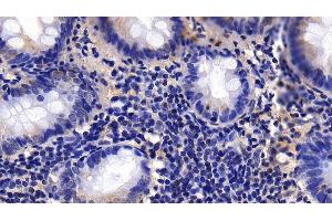 Detection of CNN1 in Human Appendix Tissue using Polyclonal Antibody to Calponin 1, Basic (CNN1) (CNN1 抗体  (AA 1-268))