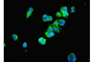 Immunofluorescent analysis of MCF-7 cells using ABIN7164978 at dilution of 1:100 and Alexa Fluor 488-congugated AffiniPure Goat Anti-Rabbit IgG(H+L) (PSMB4 抗体  (AA 46-264))