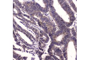 IHC analysis of BRD7 using anti-BRD7 antibody . (BRD7 抗体  (AA 514-567))