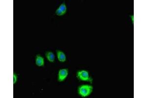 Immunofluorescent analysis of A549 cells using ABIN7169823 at dilution of 1:100 and Alexa Fluor 488-congugated AffiniPure Goat Anti-Rabbit IgG(H+L) (SLIT-ROBO rho GTPase Activating Protein 2C (SRGAP2C) (AA 1-242) 抗体)