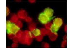 Immunofluorescence (IF) image for anti-Epstein-Barr Virus Membrane Antigen gp350 (EBV gp350) antibody (ABIN265550) (EBV-Gp350 抗体)
