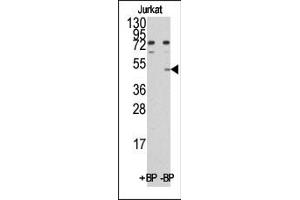 Western blot analysis of anti-MINA (C-term) Pab pre-incubated with and without blocking peptide (BP)(catlog :BP1033b) in Jurkat cell line lysate. (MINA 抗体  (C-Term))