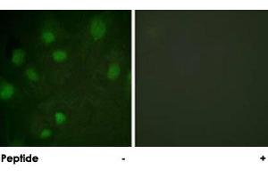 Immunofluorescence analysis of HeLa cells, using IGF2R polyclonal antibody . (IGF2R 抗体)