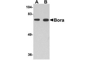 Western blot analysis of Bora in mouse brain tissue lysate with AP30161PU-N Bora antibody at (A) 1 and (B) 2 μg/ml. (BORA 抗体  (C-Term))