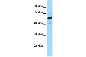 WB Suggested Anti-SUCLG2 Antibody Titration: 1. (SUCLG2 抗体  (C-Term))