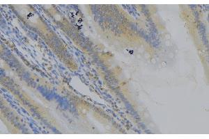 ABIN6279109 at 1/100 staining Mouse colon tissue by IHC-P. (CTNNAL1 抗体  (Internal Region))