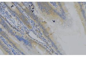 ABIN6279109 at 1/100 staining Mouse colon tissue by IHC-P. (CTNNAL1 抗体  (Internal Region))