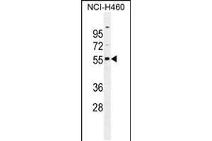 Western blot analysis in NCI-H460 cell line lysates (35ug/lane). (RASSF8 抗体  (N-Term))