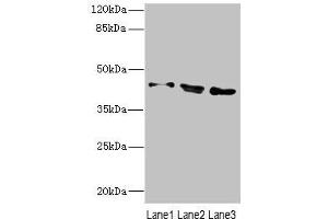 Western blot All lanes: CAMK1Dantibody at 2. (CAMK1D 抗体  (AA 1-180))