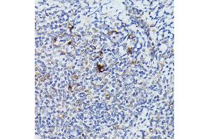 Immunohistochemistry of paraffin-embedded human tonsil using Cathepsin G Rabbit pAb (ABIN6127687, ABIN6139229, ABIN6139231 and ABIN6221273) at dilution of 1:50 (40x lens). (Cathepsin G 抗体  (AA 21-255))