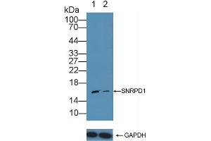 anti-Small Nuclear Ribonucleoprotein D1 Polypeptide 16kDa (SNRPD1) (AA 1-119) antibody