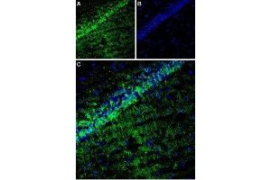 Expression of TARP γ8 (CACNG8) in rat hippocampus - Immunohistochemical staining of rat hippocampus using Anti-CACNG8 Antibody (ABIN7042996, ABIN7044073 and ABIN7044074).