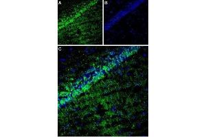 Expression of TARP γ8 (CACNG8) in rat hippocampus - Immunohistochemical staining of rat hippocampus using Anti-CACNG8 Antibody (ABIN7042996, ABIN7044073 and ABIN7044074). (CACNG8 抗体  (Intracellular, N-Term))