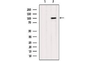 Western blot analysis of extracts from B16F10, using CTNNA1 Antibody. (CTNNA1 抗体  (Internal Region))